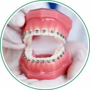 Orthodontic Treatment - tathastudental.com