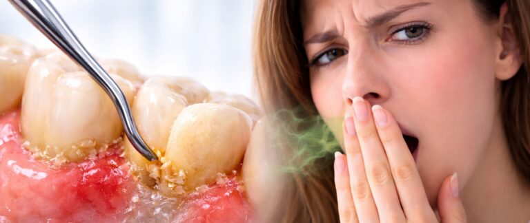 Do You Have Persistent Bad Breath?