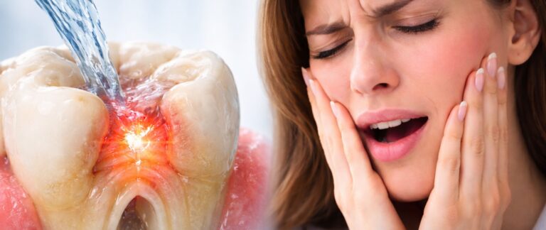 Sharp Pain with Cold Water, Ice-Cream or Air?