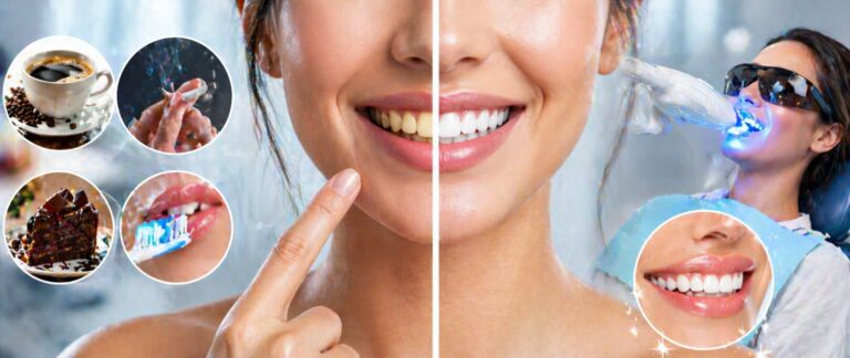 Why Do Teeth Turn Yellow? And How Can You Get Your White Smile Back?