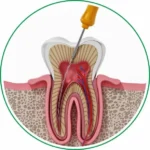 Dental Care