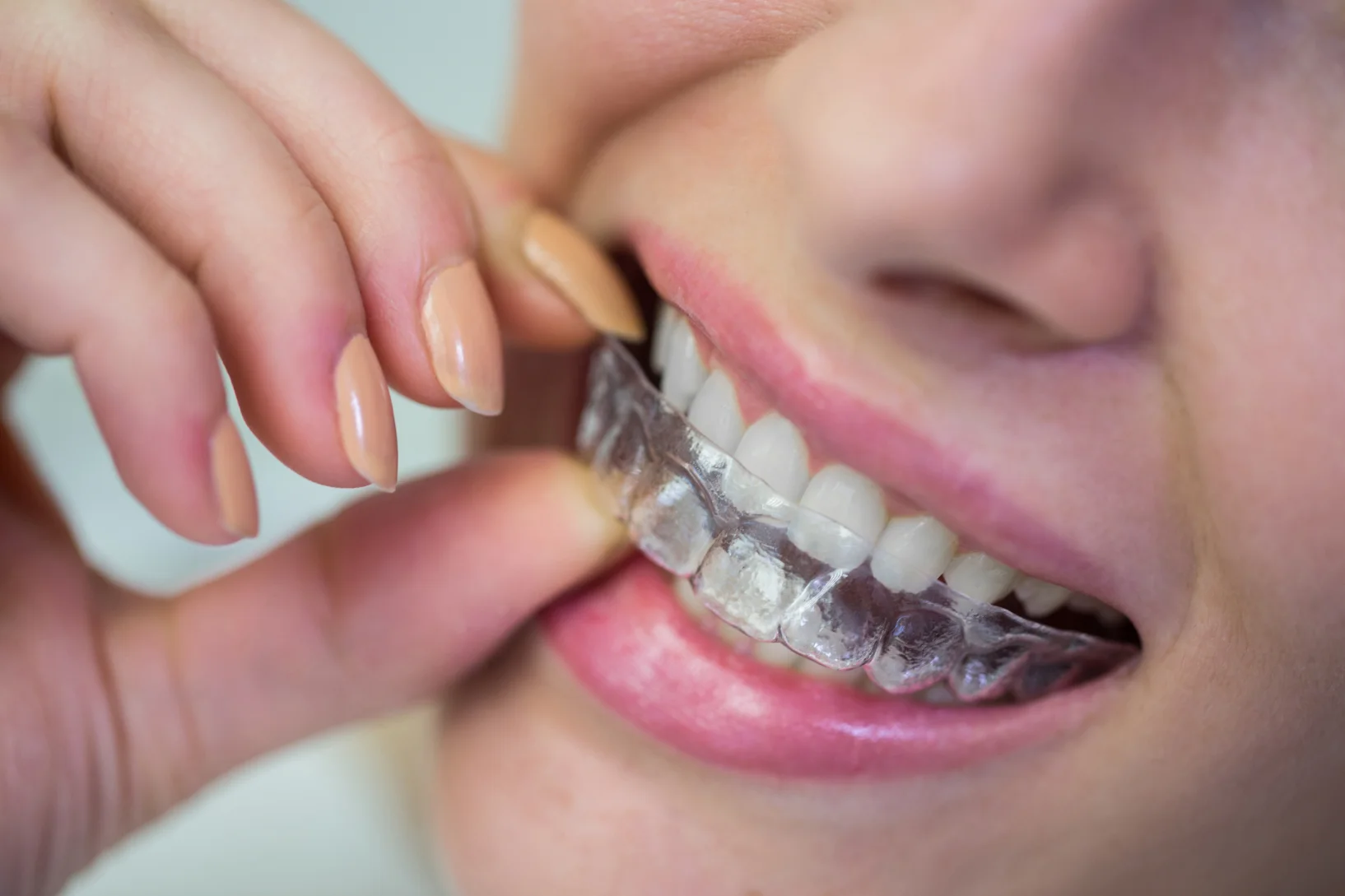 Dental Care Indore